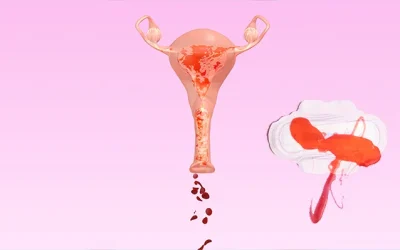 Heavy Menstrual Bleeding