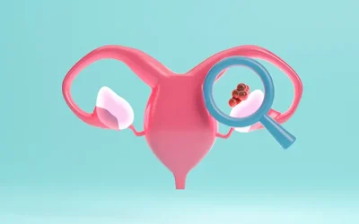 understanding ovarian cancer